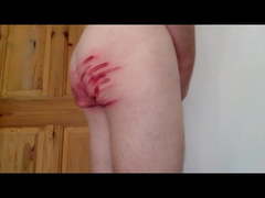 After effects of my hard caning and spanking